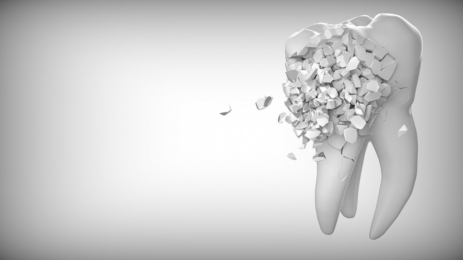 Endodoncja – jakie narzędzia wykorzystuje się w leczeniu kanałowym?