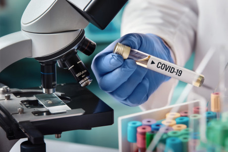 Jedenaście nowych zachorowań na COVID-19 i cztery ozdrowienia w województwie świętokrzyskim