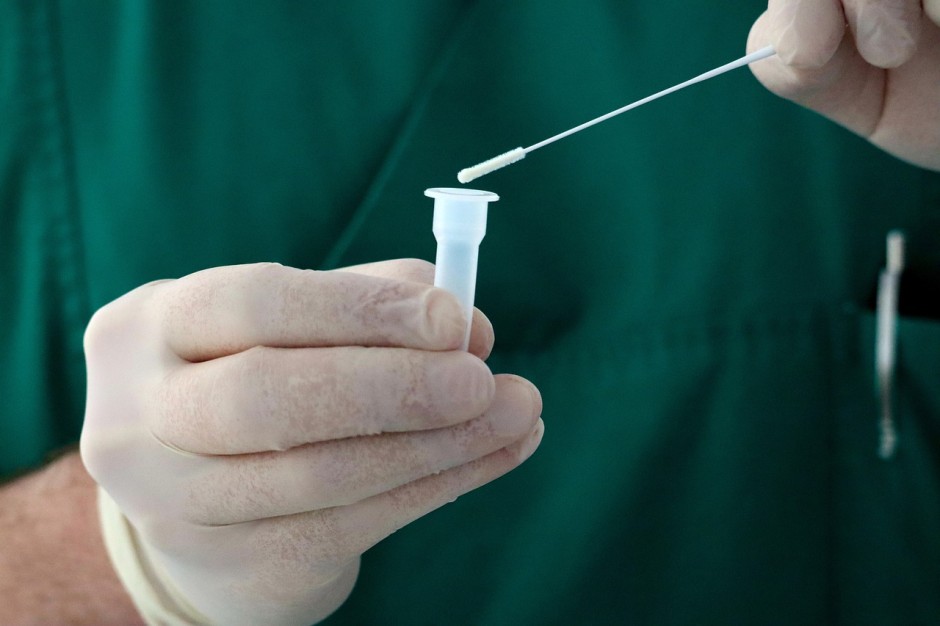 Testy na HIV dostępne u lekarza pierwszego kontaktu